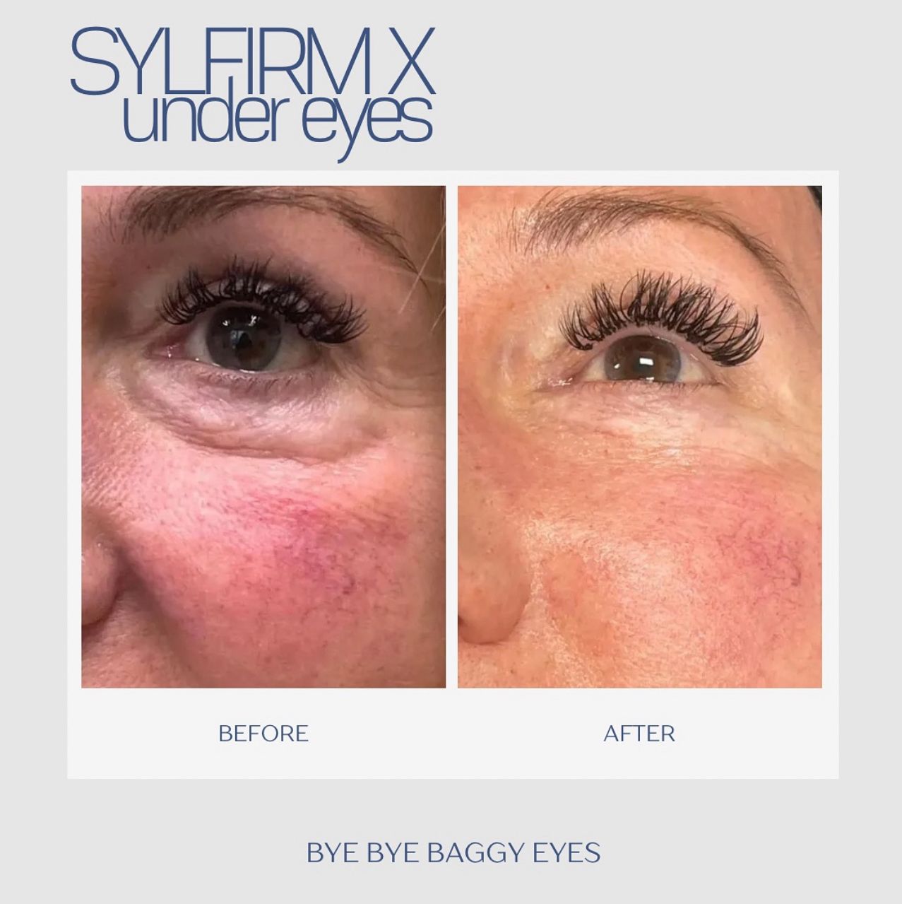 Before After Treatment 7